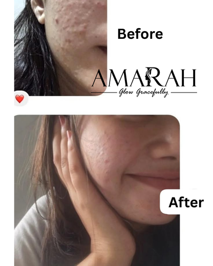 Amarah Glow Night Cream - 20g